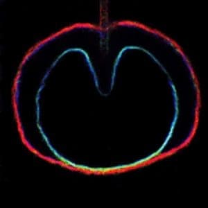 XTC Wasp Star (Apple Venus Vol. II)